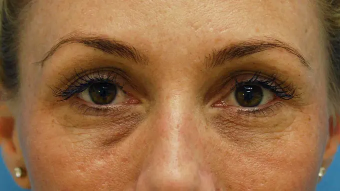 Kulit Wajah Sudah Lelah Tuh, Coba Istirahat Pakai Makeup Dulu