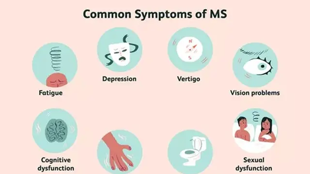 Gejala Multiple Sclerosis