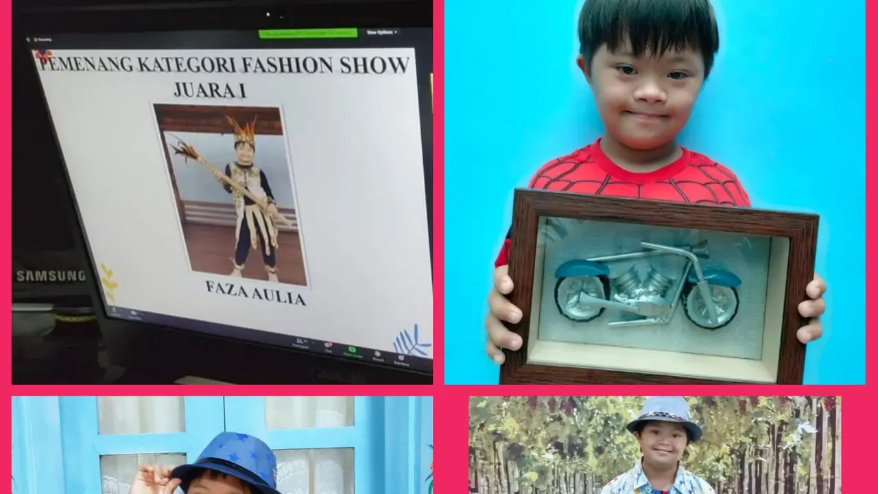 Bocah Down Syndrome Asal Malang M. Faza Aulia Rahadiyanto.