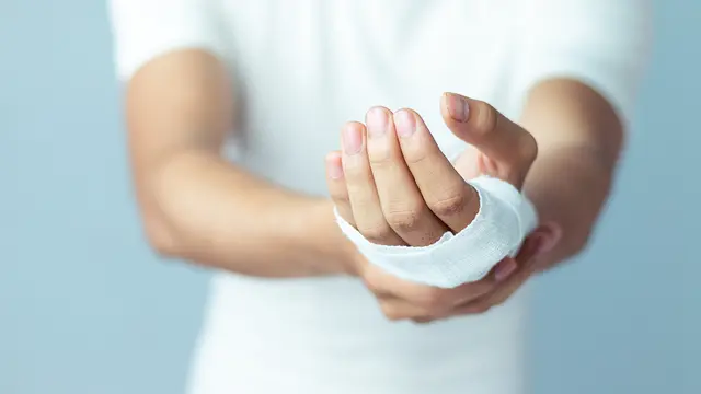 ilustrasi menyembuhkan memar dengan cuka/shutterstock