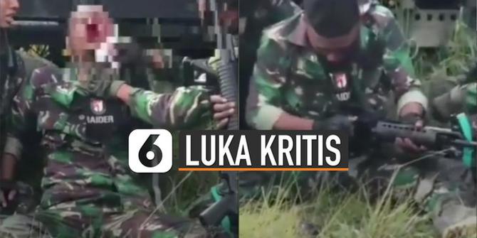 VIDEO: Viral Prajurit TNI Luka Kritis di Wajah, Tetap Patuh Protokol Senjata