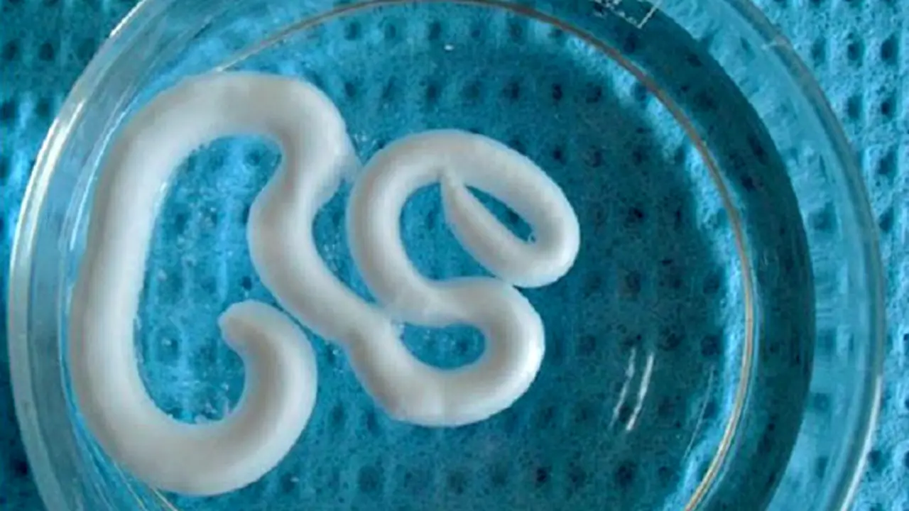 Suntikan Gel Untuk Mengatasi Osteoporosis