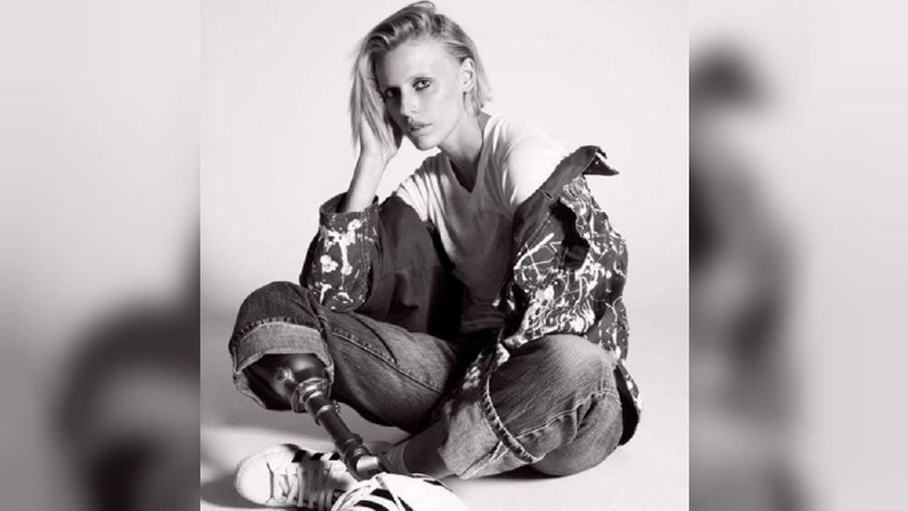 Lauren Wesser (Instagram/@theimpossiblemuse)