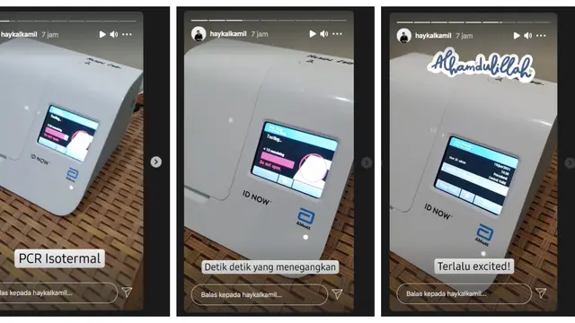 Haykal Kamil Dinyatakan Telah Negatif Covid-19. (instagram.com/haykalkamil)