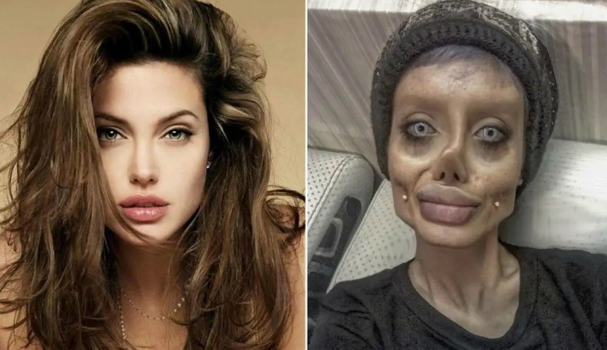 Setelah melabeli dirinya sebagai fans nomor satu Angelina Jolie, Sahar menunjukkan bahwa operasi pelastik bisa mengubah wajah seseorang jadi mengerikan. (India Today)