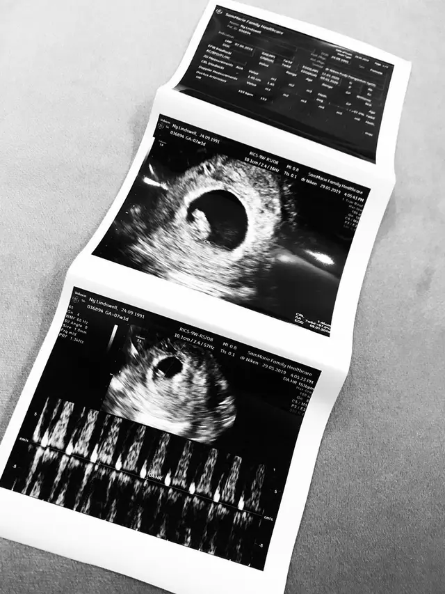 Lahirkan Anak Pertama, Ini 6 Potret Perjalanan Kehamilan Lindswell Kwok
