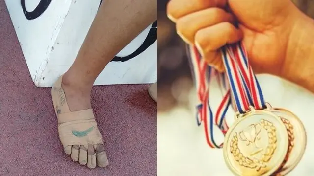 Pakai Perban Sebagai Pengganti Sepatu, Atlet 11 Tahun Ini Raih 3 Medali Emas