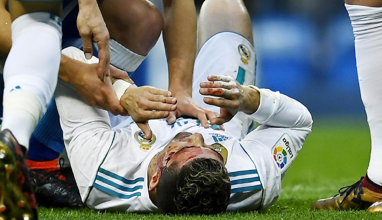 Striker Real Madrid, Cristiano Ronaldo, mengalami pendarahan di bagian pelipis saat melawan Deportivo La Coruna pada laga La Liga di Stadion Santiago Bernabeu, Minggu (21/1/2018). Real Madrid menang 7-1 atas Deportivo La Coruna. (AFP/Oscar Del Pozo)