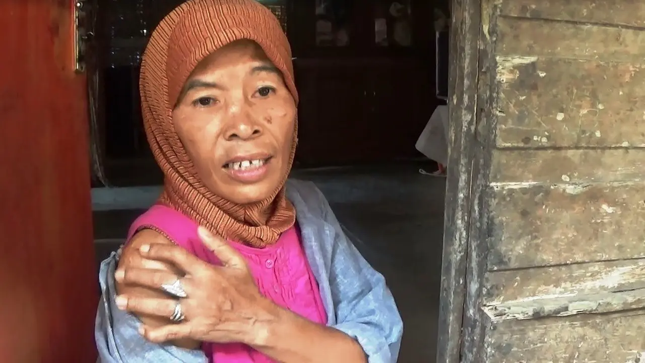 Siksaan Berujung Jari Remuk TKI Cianjur di Negara Petrodolar