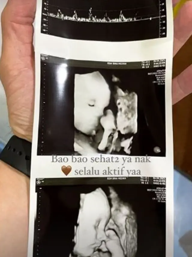 Lahir Sebelum Baby Shower, Ini 6 Momen Bahagia Persalinan Audi Marissa