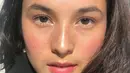 Chelsea Islan pernah unggah foto dengan ada bintik-bintik di wajahnya. Ia tak mempermasalahkan penampilannya yang freckles karena ia lebih senang mencintai diri sendiri apa adanya. Potret Chelsea Islan tampil freckles ini banjir pujian. (Liputan6.com/IG/chelseaislan)