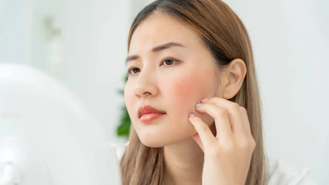 How To: Menenangkan Kulit Wajah Kemerahan Menurut Anjuran Ahli Dermatologi, Ternyata Praktis Kok!