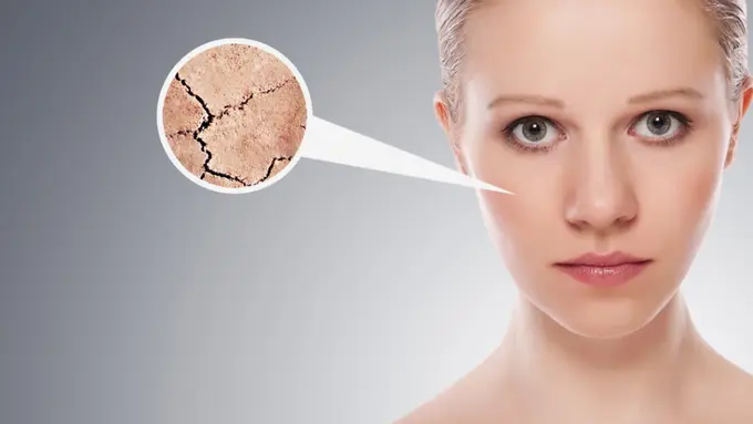 3 Cara Hilangkan Kulit Kering di Wajah Tanpa Dokter