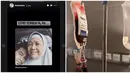 Bagikan kabar sang ibu jatuh sakit hingga diketahui sampai harus dibawa ke rumah sakit, doa atas kesembuhan ibunda Teuku Wisnu ramai dibububuhkan netizen dan rekan artis di kolom komentar. Hanya unggah foto infus transfusi darah, belum diketahui sakit tapa yang diderita ibu Teuku Wisnu. Namun melansir dari berbagai sumber, Ibu Wisnu ada riwayat penyakit darah tinggi dan gula. (Liputan6.com/IG/@teukuwisnu)