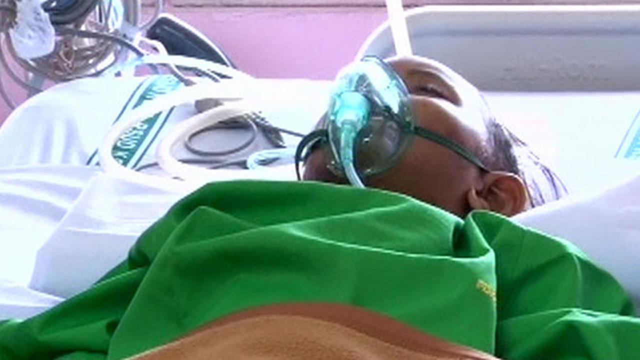 Kondisi Iqbal Semakin Kritis