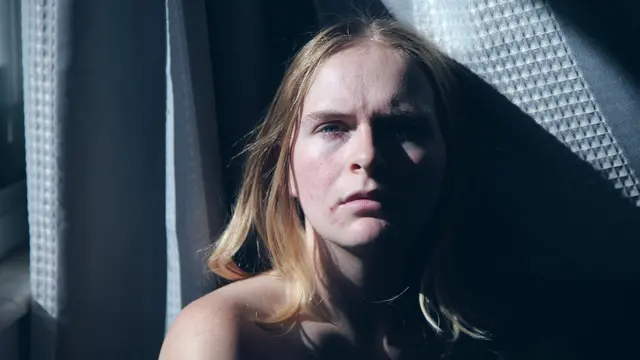 Jangan Pecahkan Jerawat Batu Sembarangan Jika Tidak Mau Hal Ini Terjadi