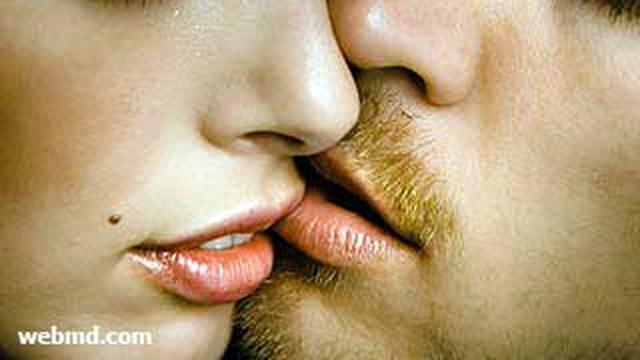 Awas Ciuman Menularkan Herpes Health Liputan6 Com