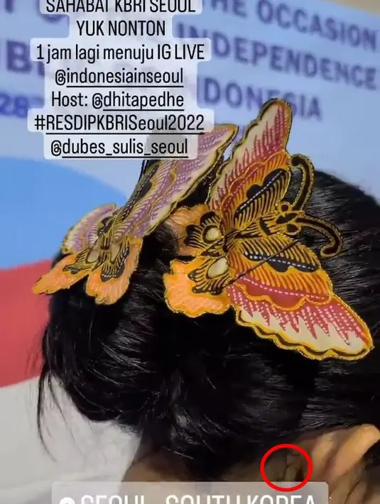 Terakhir ada satu tato di belakang telinga. Ini merupakan lambang Lockey, fanbase Secret Number. Tato tersebut jadi bukti cinta Dita untuk penggemar. [Dok/KapanLagi.com]