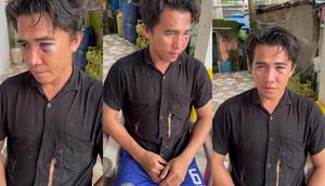 Pria di Maros Korban Pengeroyokan Diduga Polisi (Foto: Fauzan/Liputan6.com)