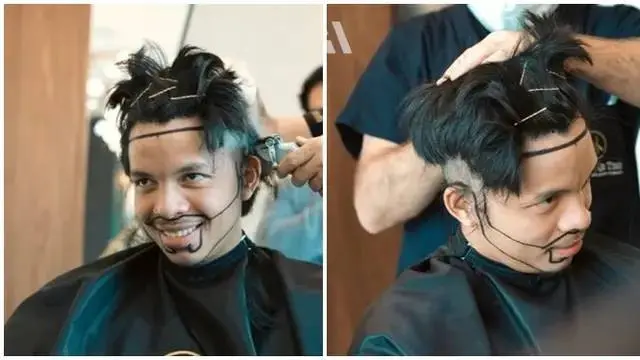 7 Potret Seleb Jalani Transplantasi Rambut, Hasilnya Makin Keren