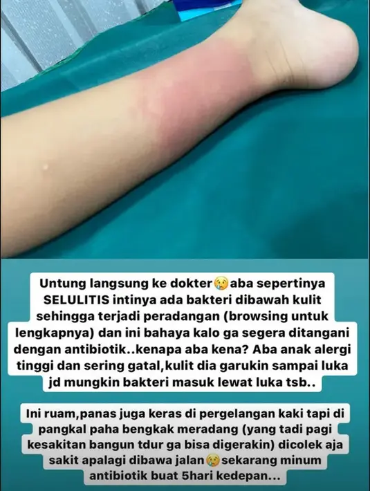 Zaskia Adya Mecca (Instagram/zaskiadyamecca)