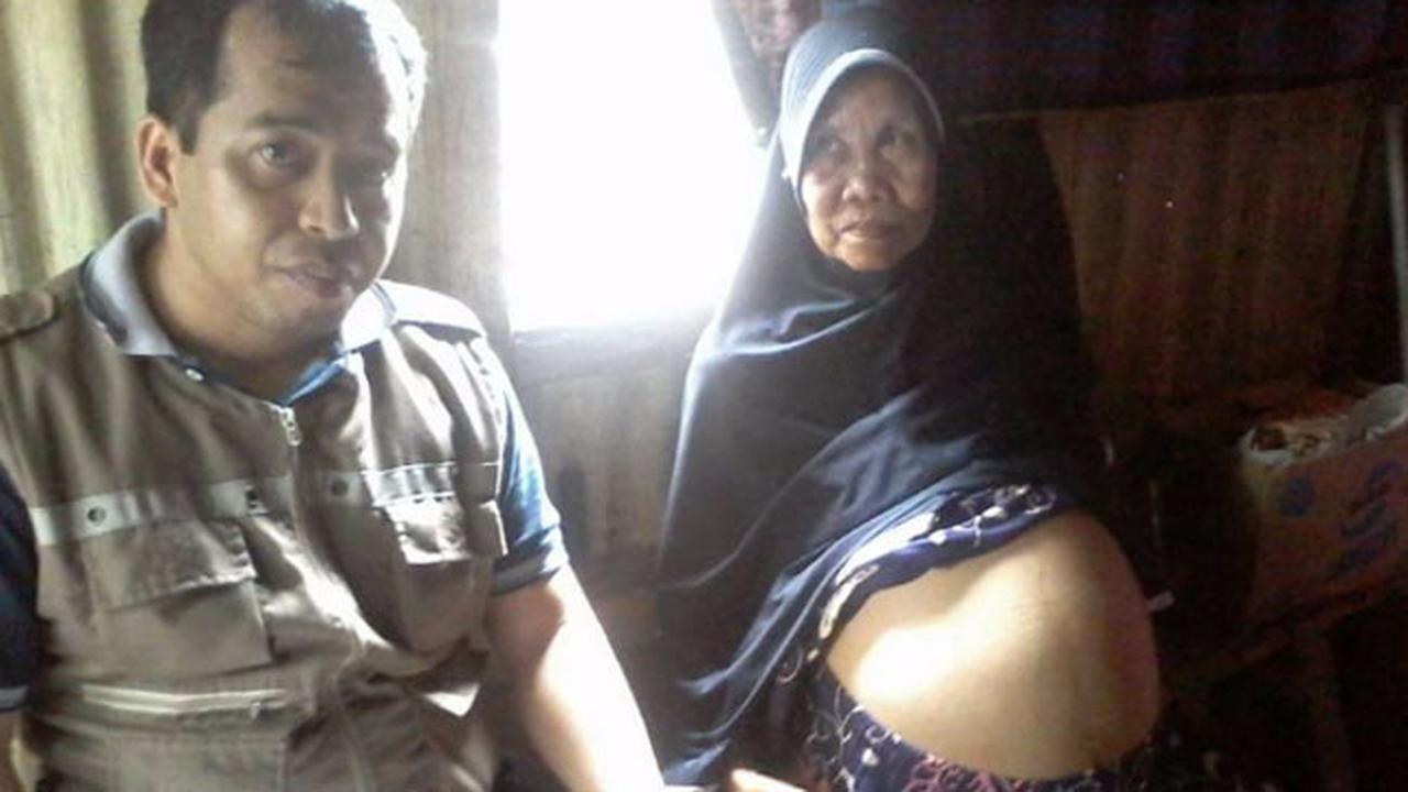 Nenek Sebatang Kara, 20 Tahun Idap Tumor Adnexa 