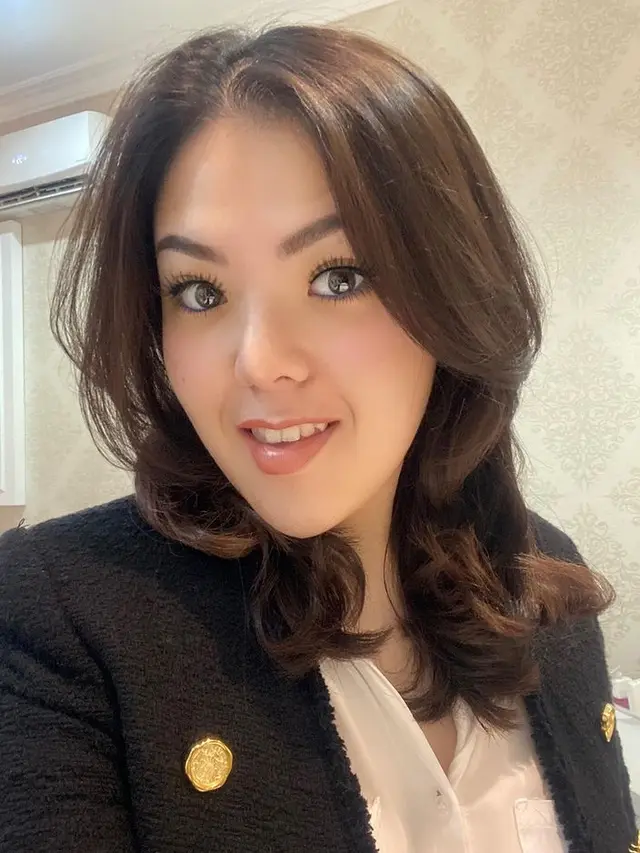 8 Potret Penampilan Baru Tina Toon dengan Wajah Tirus, Bikin Pangling