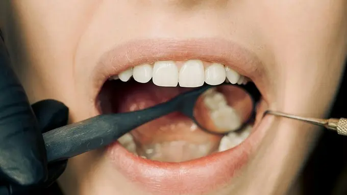 Benarkah Sering Minum Teh Membuat Gigi Menjadi Kuning?