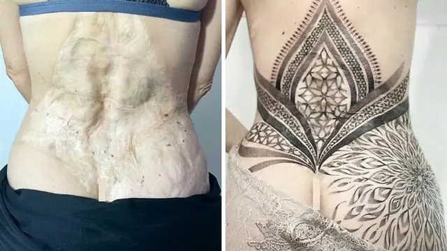 Gunakan Tato Untuk Menutupi Bekas Luka, 6 Potret Hasilnya Bikin Takjub. (Sumber: Boredpanda)
