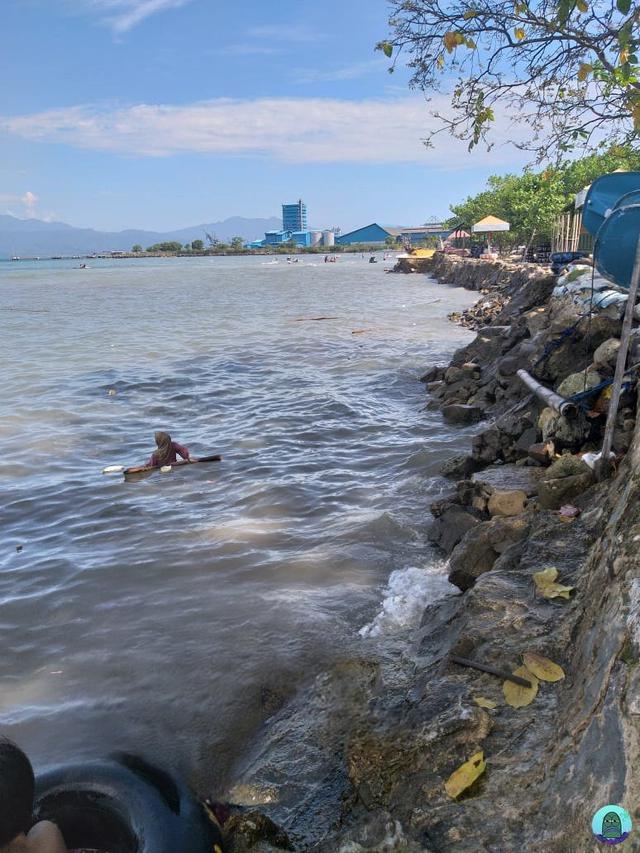 Wanita Ini Minta Foto Tangannya Diedit Pindah Depan, 8 Hasilnya Bikin Enggak Habis Pikir