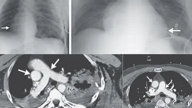 Foto: Copyright ListVerse.com