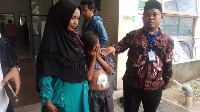 Bocag Arazaqul memperlihatkan bekas luka di perutnya karena penganiayaan beberapa tahun lalu.