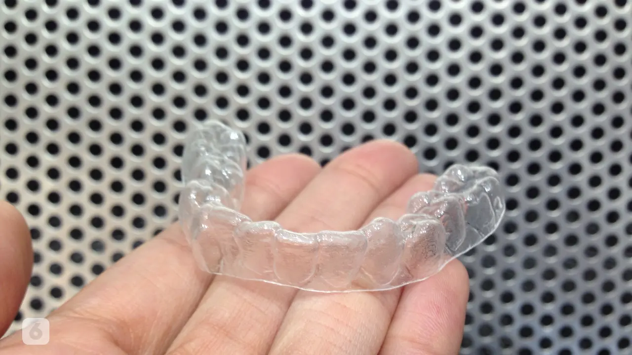 Clear aligner Rata