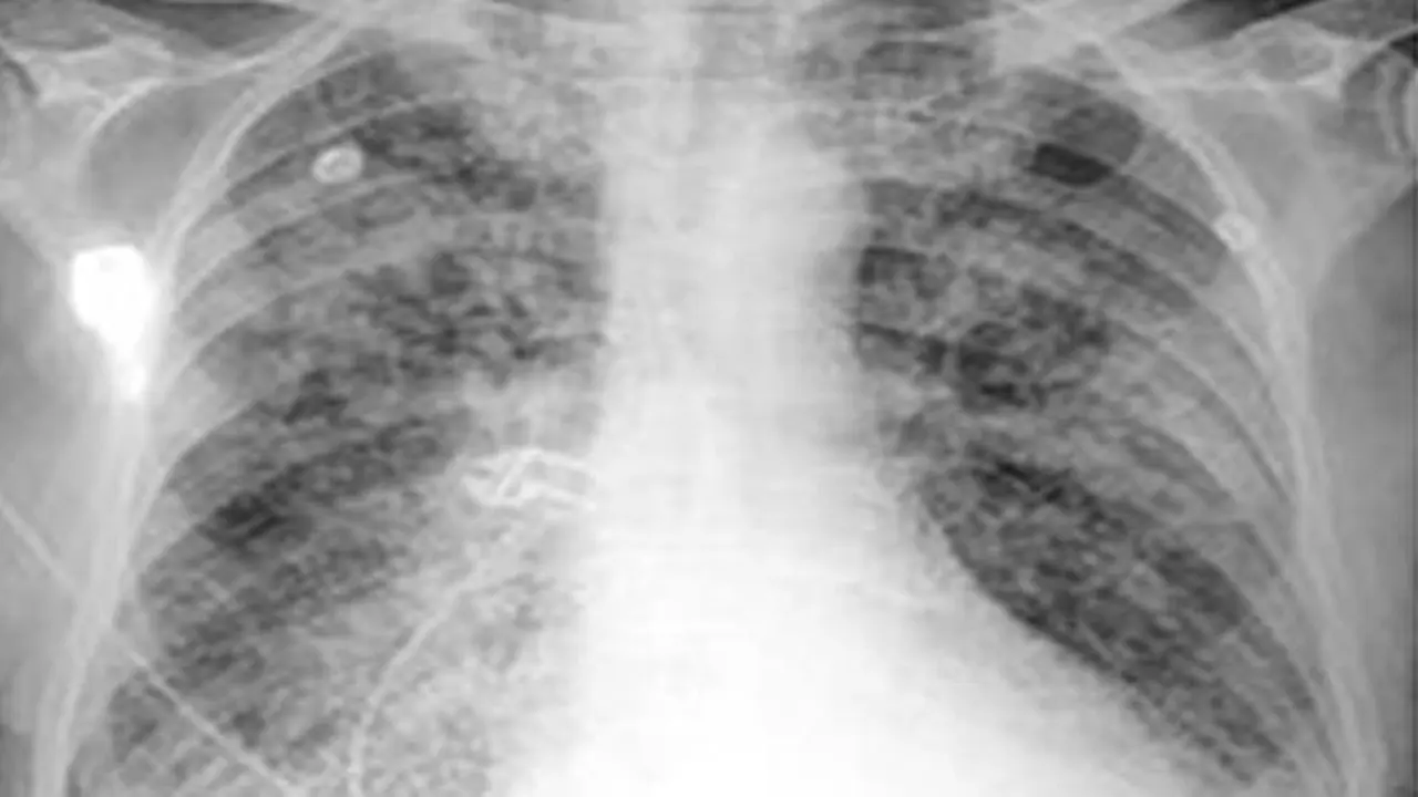 hepatomegali-130710b.jpg