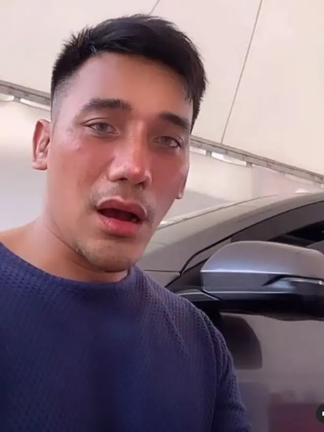 Ungkap Alasan Operasi Plastik, Ini 6 Potret Terbaru Bubah Alfian yang Bikin Pangling