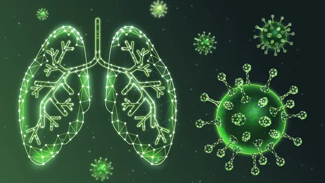 Pneumonia