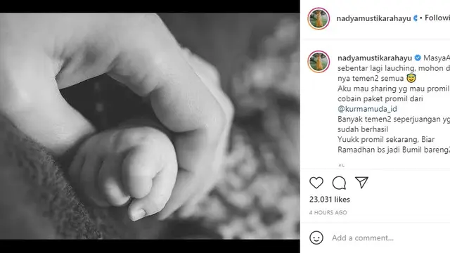 Nadya Mustika Rahayu, istri Rizki 2R (Foto: Instagram/@nadyamustikarahayu)
