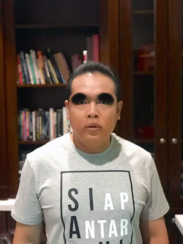 6 Editan Foto Adam Suami Inul Daratista Kembali Berkumis Ini Bikin Ketawa Geli