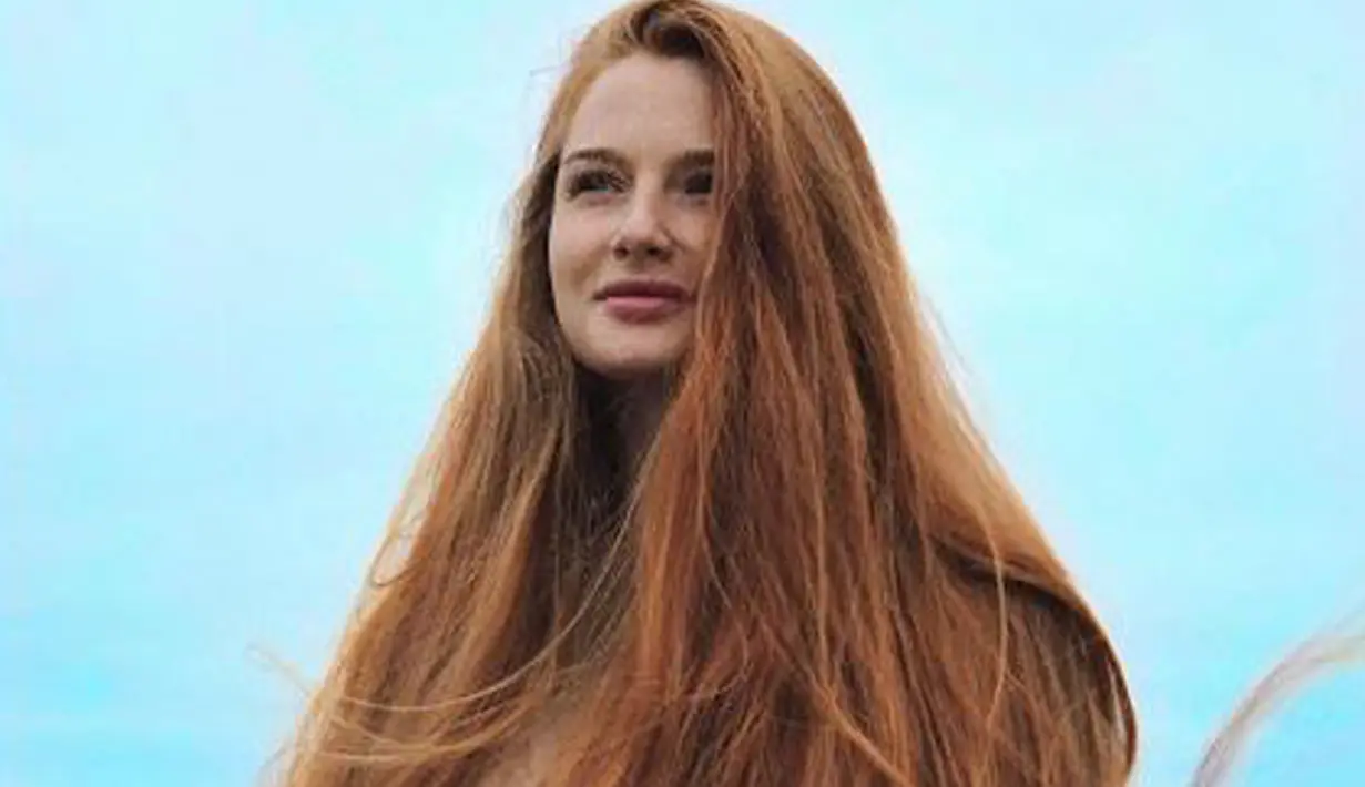 Sebenarnya Anastasia Sidorova telah menderita alopecia atau kerontokan parah. Pada usia 18 tahun rambutnya rontok parah dan menyisakan bintik-bintik buruk yang terlihat di kepalanya. (instagram.com/sidorovaanastasiya)