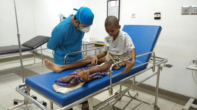 Kaki remaja di Natuna nyaris membusuk karena infeksi dan tak mampu berobat. (Foto: Batamnews.co.id)