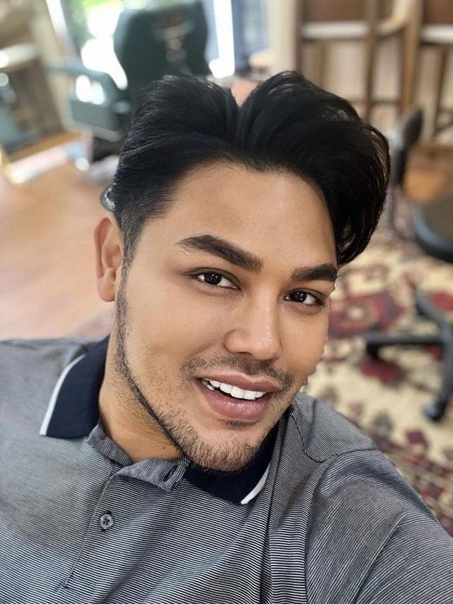 6 Potret Terbaru Ivan Gunawan Usai Turun 47 Kg, Segera Operasi Payudara