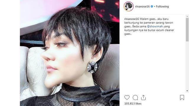 Punya Hidung Dan Dagu Lancip Rina Nose Suntik Filler Showbiz Liputan6 Com