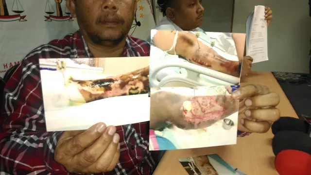 Keponakan Nassar-Muzdalifah Mengaku Alami MalapraktIk