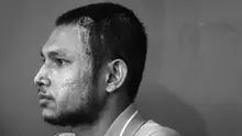 Pemain Malaysia, Faisal Halim saat jumpa pers pemusatan latihan Selangor FC di Padang SUK Shah Alam, Kamis (13/6/2024). Terlihat luka bakar di sejumlah bagian tubuhnya akibat insiden penyiraman air keras oleh orang yang tak dikenal pada 5 Mei 2024. (AFP/Arif Kartono)