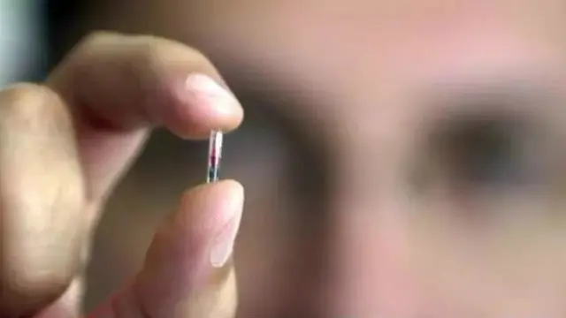 Microchip manusia (1)