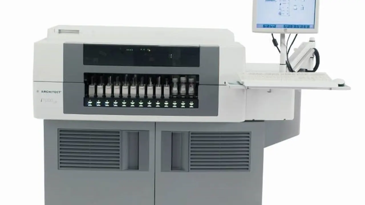 Alat Tes IgG SARS-CoV-2 Abbott