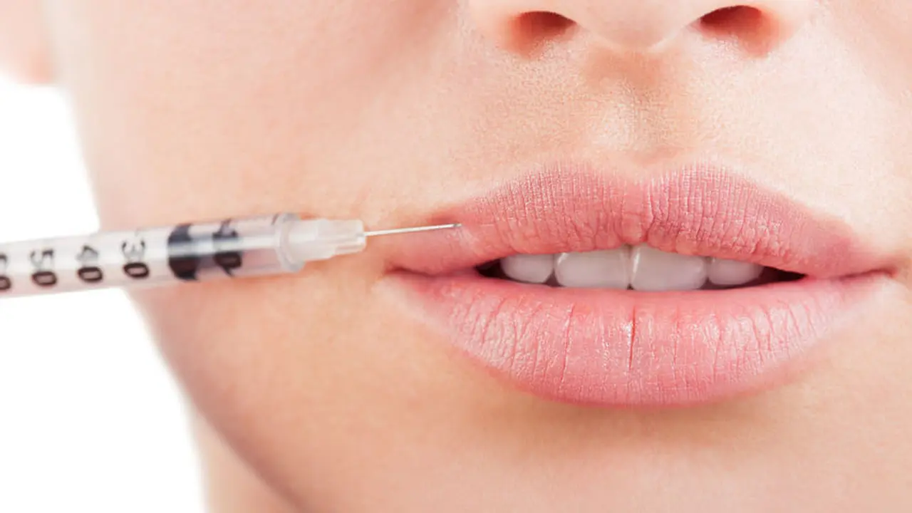 Menyingkap Cara Kerja dan Manfaat Suntik Filler