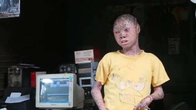 Begini Keseharian Ari si Kulit Ular