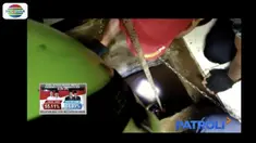 Dua pekerja galian sumur tewas saat membersihkan sumur tua sedalam 5 meter milik warga Karang Tengah, Sukabumi.
