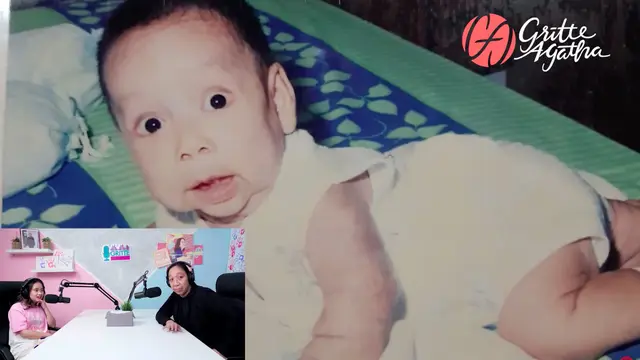 Idap Penyakit Langka, Pria Berusia 20 Tahun Ini Miliki Wajah Bak Lansia. (Sumber: YouTube/Gritte Agatha)